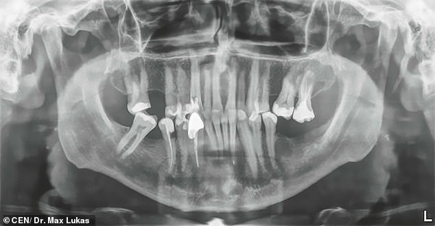 tooth (1).jpg