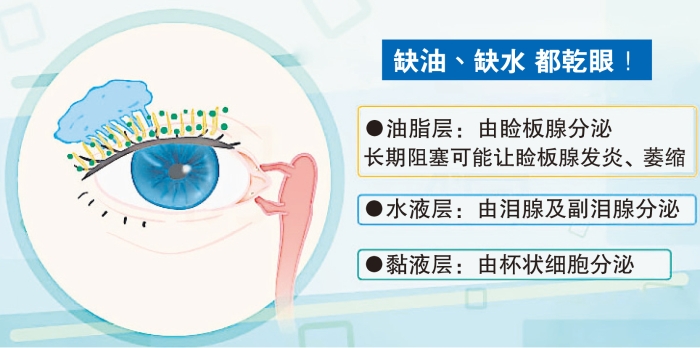 乾眼症02.jpg