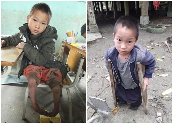 陆晨与祖母住在越南北部与世隔绝的村落，他到墨尔本就医前，最远到过的地方是离家40公里的学校。（互联网照片）