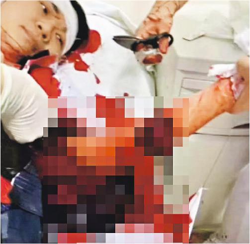 四川3名医生抢救病人期间遭病人家属群殴，其中一名医生（图）受伤流血。（图：网络照）