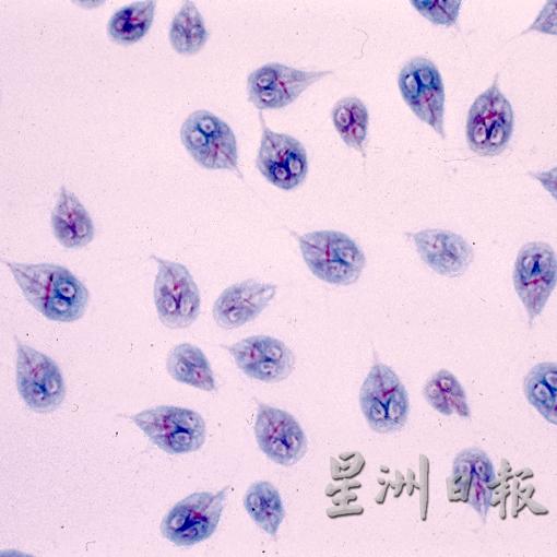 贾第鞭毛虫是陈忠凯在实验中找到的寄生虫，图为梨形鞭毛虫滋养体。（受访者提供：摘自网络）
