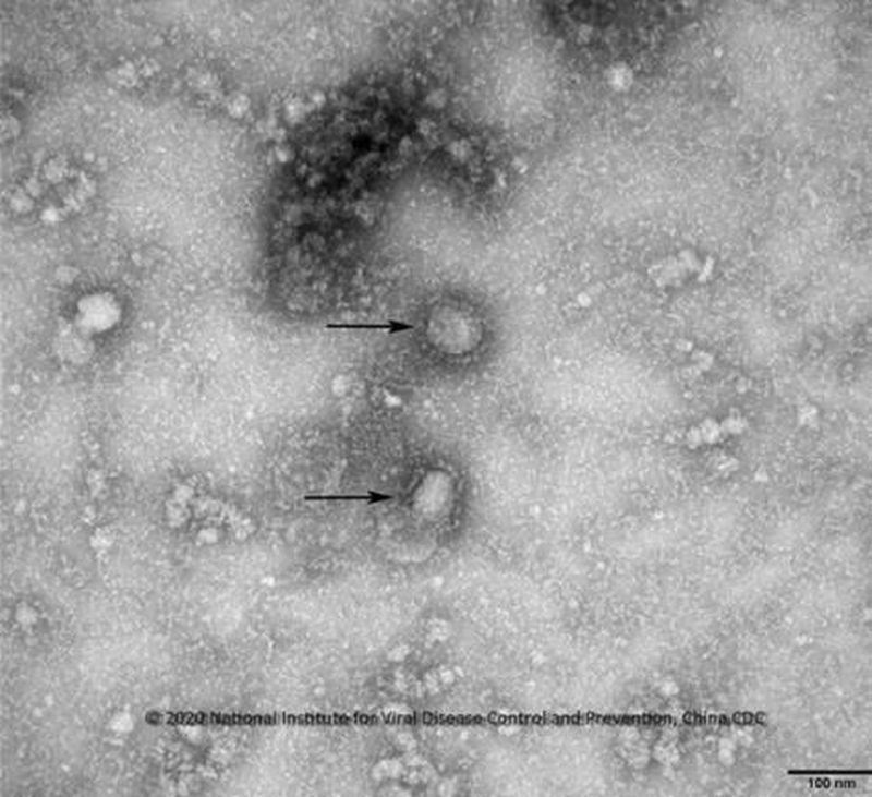 世界卫生组织秘书长谭德塞11日宣布，为避免武汉肺炎污名化特定地理位置，正式将武汉肺炎命名为COVID-19。图为电子显微镜下的新型冠状病毒。