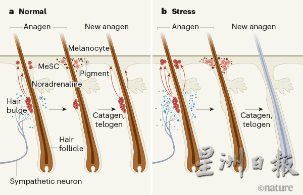 压力造成交感神经释放“去甲基肾上腺素”（Norepinephrine），被附近毛囊的干细胞吸收，因此加速分化成制造色素的细胞。一旦耗尽就无法再制造色素，犹如头发的染料短缺，毛发转灰变白。（图取自《自然》网站）