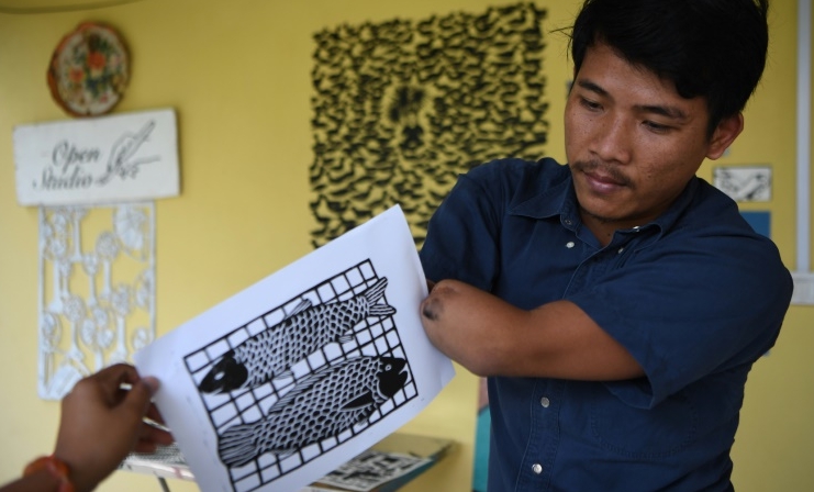 Whispered insults, social isolation, and lost opportunities -- Morn Chear is channeling the stigma he has endured since he lost both his hands a decade ago into artwork that highlights the hardships of Cambodia's disabled. AFP Whispered insults, social isolation, and lost opportunities -- Morn Chear is channeling the stigma he has endured since he lost both his hands a decade ago into artwork that highlights the hardships of Cambodia's disabled. AFP
