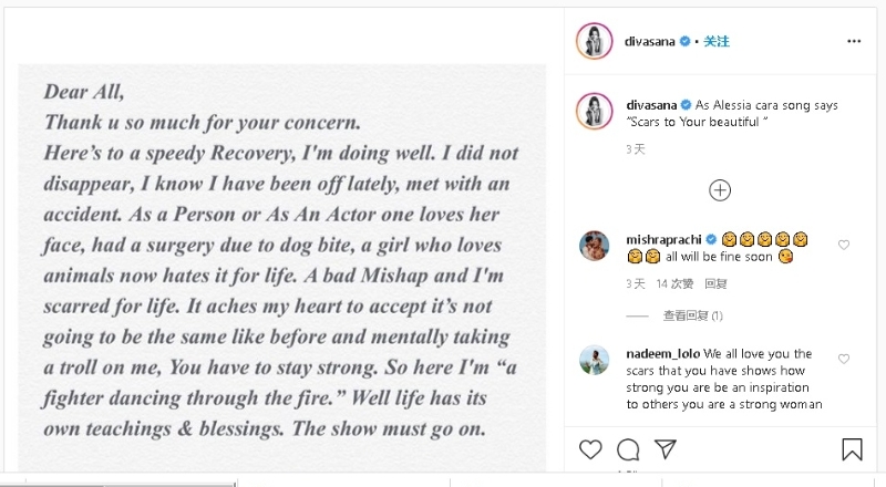 莎娜麦布提起歌曲《Scars To Your Beautiful》并在IG晒出图片，图片里的文字皆讲述她最近遭遇的意外和心情。
