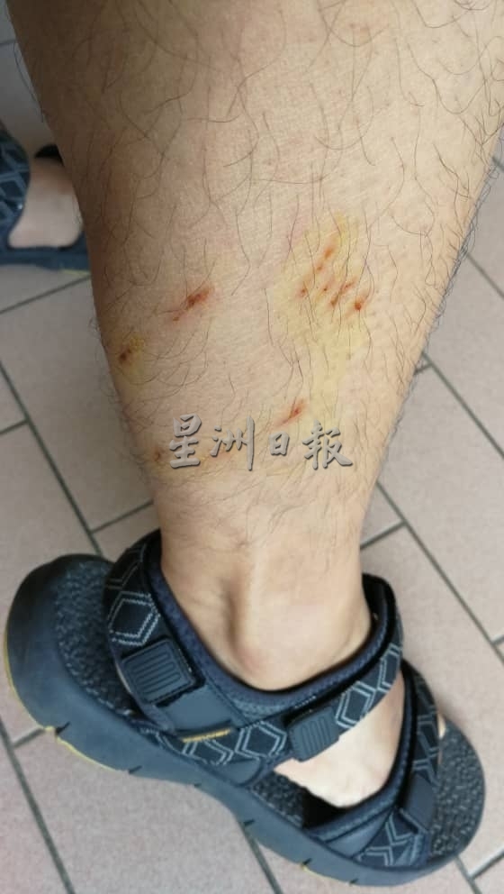 
《星洲日报》派报员刘先生昨日清晨派发报纸时，被订户的家犬咬伤右脚。