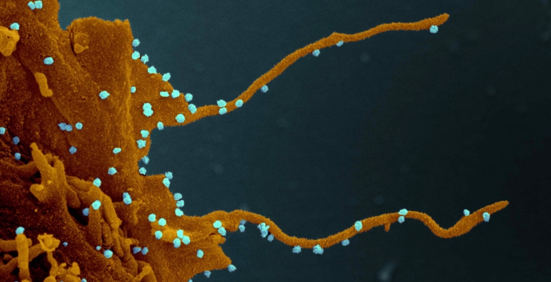 带有病毒的细胞会长出类似触须的丝状体。（图：互联网）