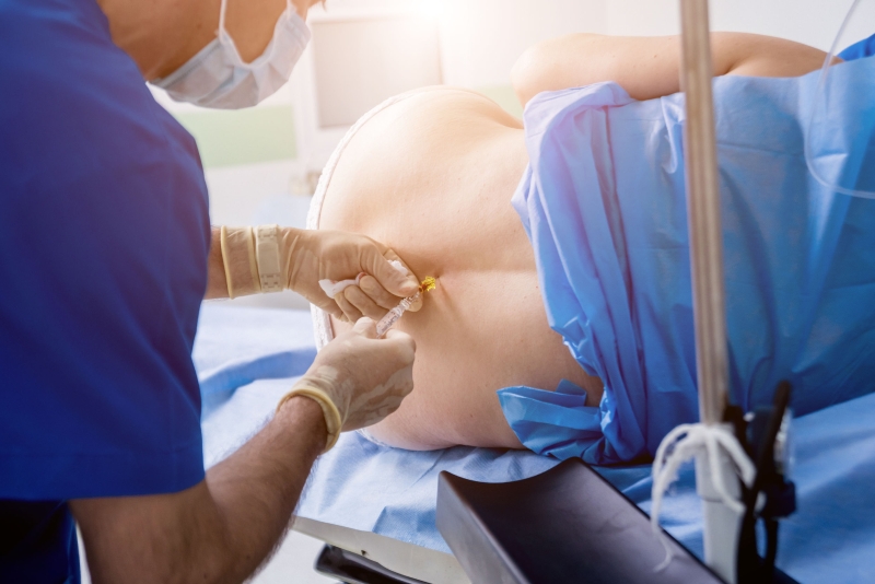 专家认为, 硬脊膜外麻醉不但有助于生产时的安全,而且还可协助孕妇产后快速恢复。