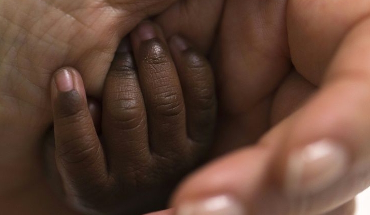 Black children in the US have a 3.5 times greater risk of dying from an operation than white children, according to a study. AFP