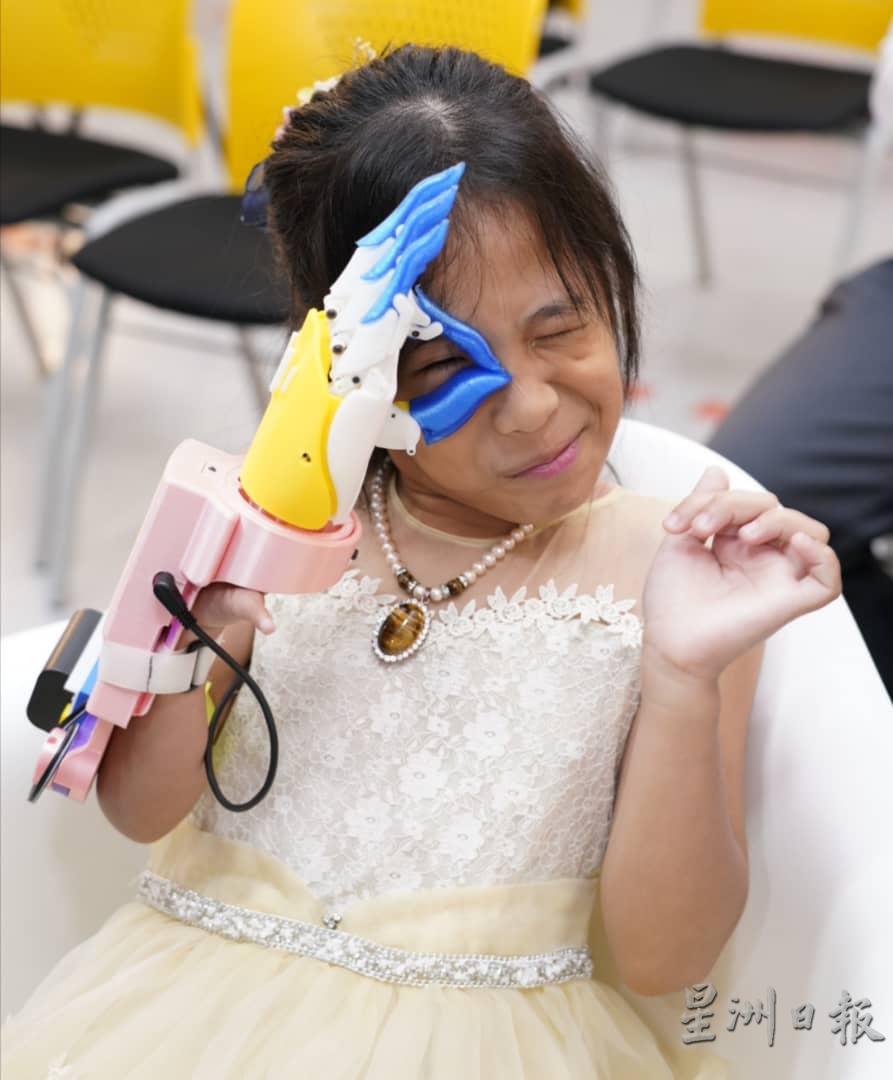 依扎阿迪娜获赠3D打印电子义肢欣喜圆梦，使用义肢比出“OK”手势放在眼睛上卖萌拍照。