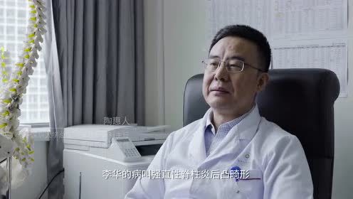 李华的主治医生陶惠人说，全世界每1000人中就有2人会患强直性脊柱炎，而像李华这么严重的，更是千分之二里面的唯一。