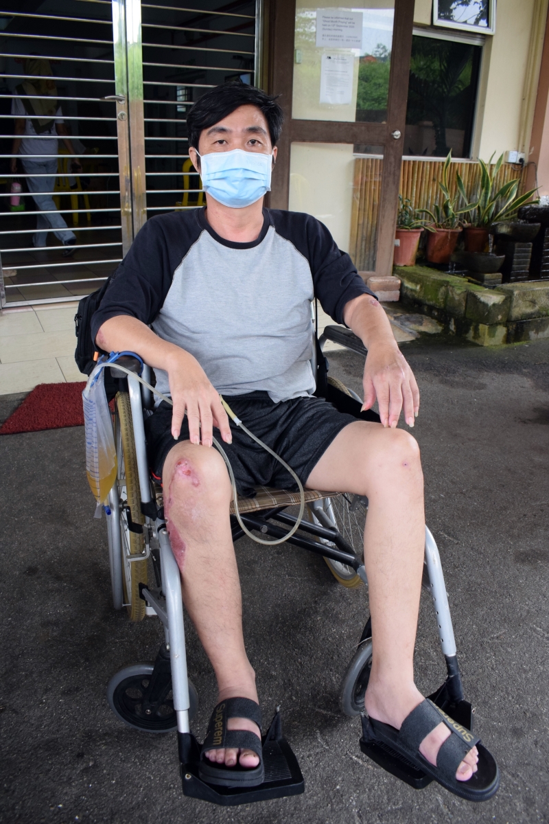 刘德顺车祸后伤到盆骨暂时不良于行，除了复健，他日后还需进行尿道手术，不知何时能够返回工作冈位。