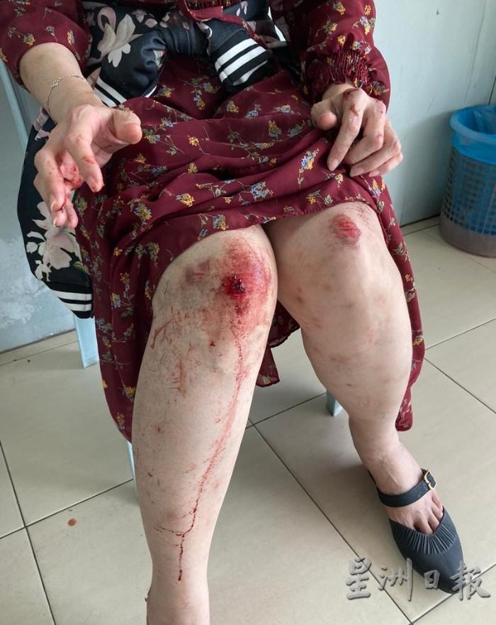 女老师被攫夺匪拖拉数十尺，手脚受伤。