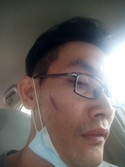 林泰成被警员赏了3记耳光，脸上也留下了伤痕。