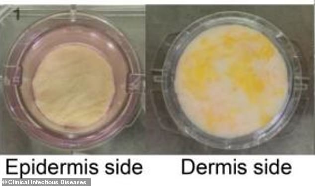 研究人员将皮肤细胞分别与冠病病毒和A型流感病毒样本混合。（图：互联网）