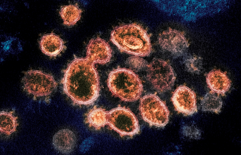 美国疾控中心周一修订冠病病毒指引，承认在一些情况下，冠病病毒可经空气中的颗粒传播。CDC继续建议人们保持6英尺的距离，戴口罩，洗手，以避免病毒传播。（图：美联社）