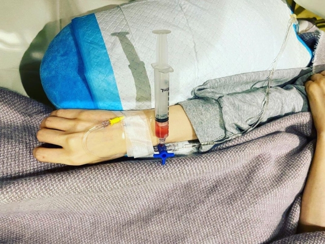 李明蔚上周接受免疫细胞治疗疗程。