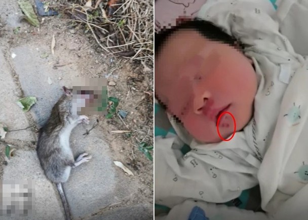 老鼠咬伤女婴。（图：网络照）
