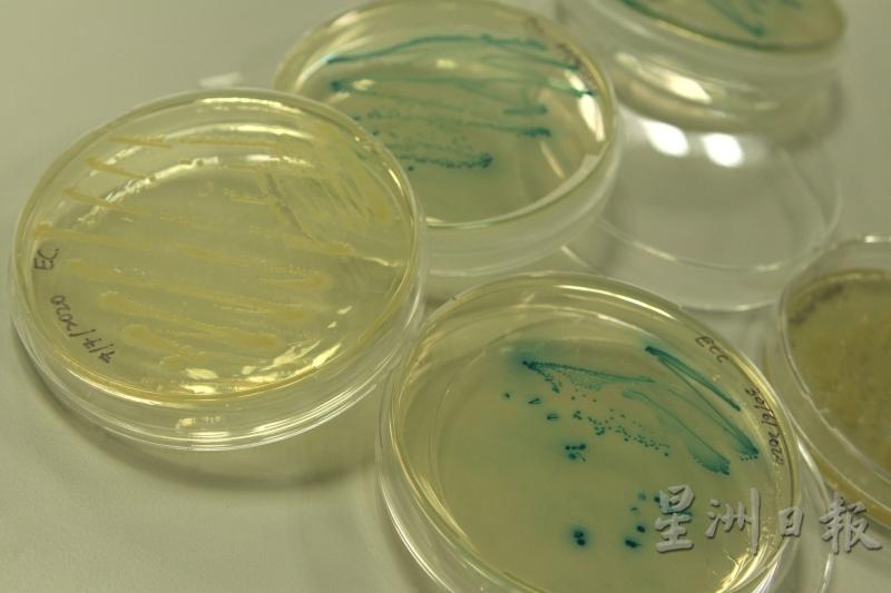 眼前分别有不同颜色的细菌培养皿，红色和紫色是可以传染或令人生病的细菌，青色则是大肠杆菌。