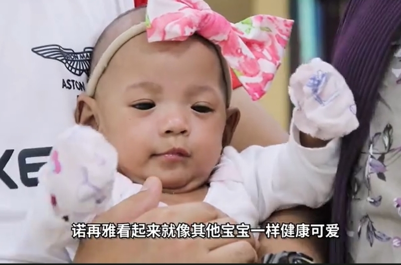 诺再雅在国大医院加护病房奋战131天后，两个多月前终于顺利出院，是新加坡成功救活的最轻早产儿之一。


