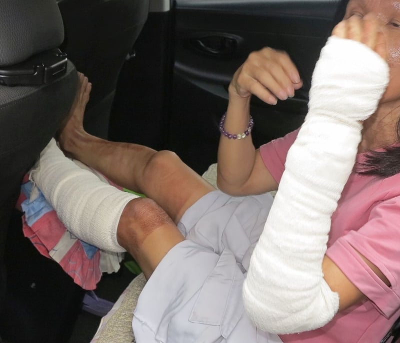 女伤者左脚及左手等被灼伤，目前在疗养中。