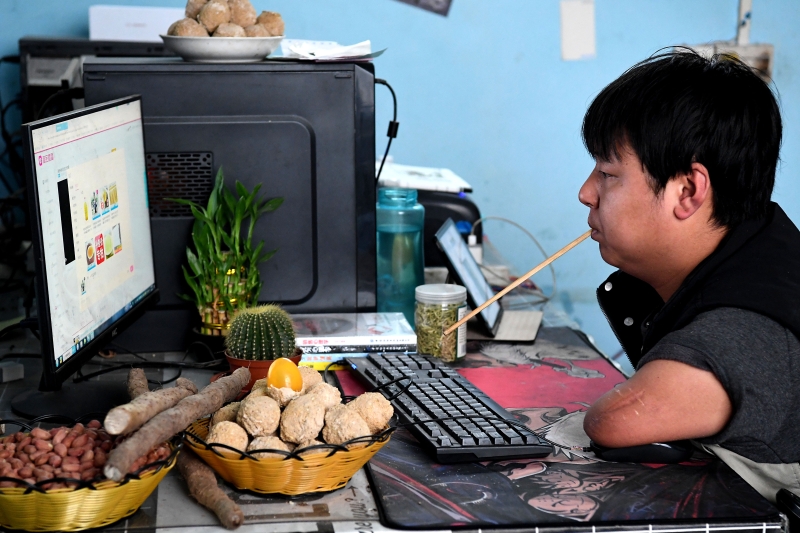 孙亚辉坚持每天直播8个小时，用残臂滑动鼠标，用嘴含着筷子敲打键盘。（图：新华社）