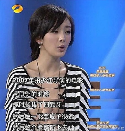 杨幂曾在节目上透露拔牙瘦脸。