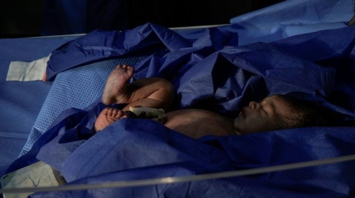 According to WHO, about 7,000 newborns die every day globally, mainly in poor countries. AFP