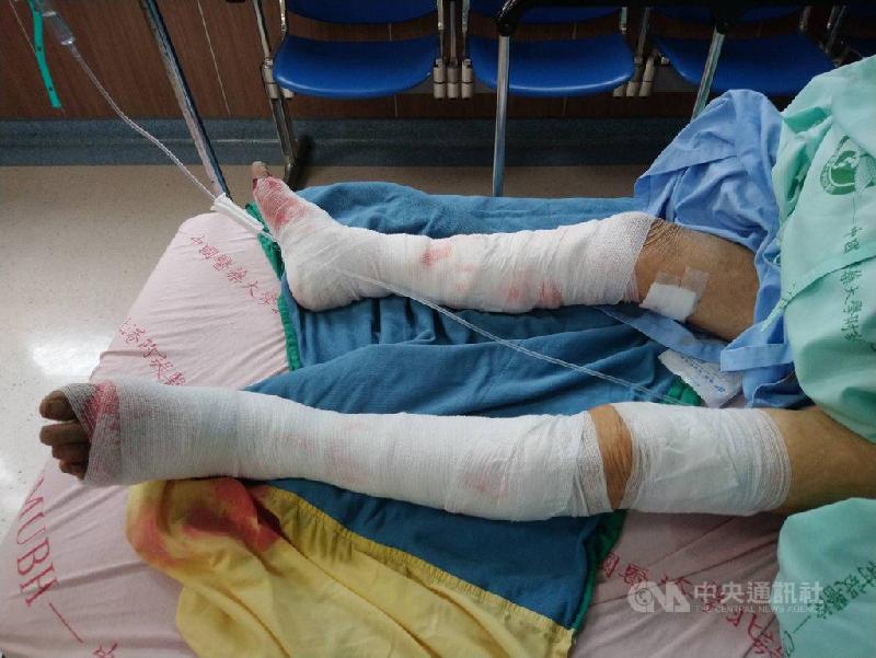 台湾云林县水林乡90岁陈姓阿嬷7日下午准备到农田工作，突然被7丶8只狗攻击，双脚受伤严重，目前在医院治疗。（图：中央社·民众提供）