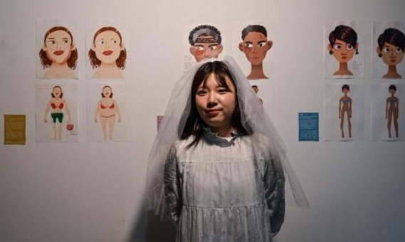 At the height of her eating disorder Zhang Qinwen was the weight of a child. Her hair fell out, she was unable to walk and she could barely see. AFP