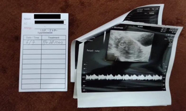 事主指超音波检查的结果显示，妻子腹中的胎儿以没有心跳了。