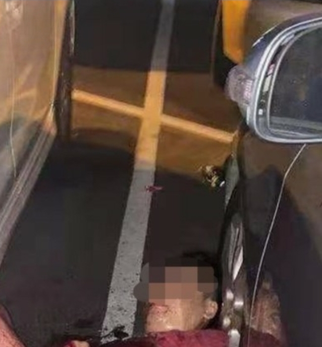 伤者全身浴血蜷縮在停车处，腿部严重被砍伤，十分骇人。（取自网络）